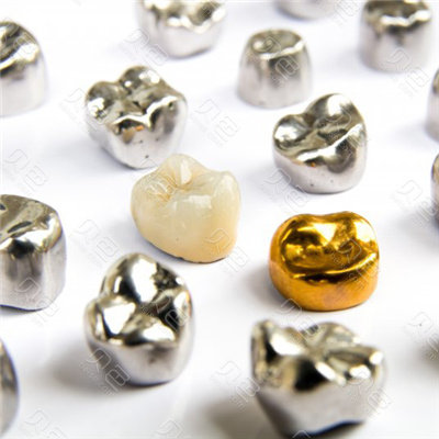 贵金属烤瓷牙的种类(贵金属烤瓷牙的种类图片)