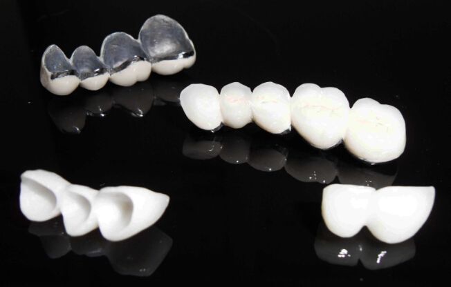 半贵金属烤瓷牙(半贵金属烤瓷牙是什么材质)