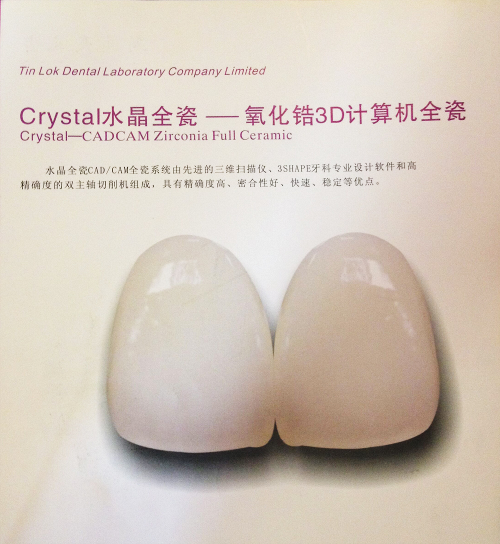 半贵金属烤瓷牙(半贵金属烤瓷牙是什么材质)