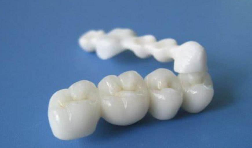 贵金属烤瓷冠(贵金属烤瓷冠的金属基底冠厚度为)