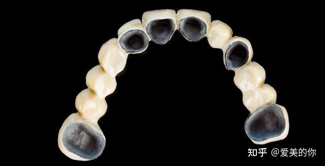 贵金属烤瓷牙的种类(贵金属烤瓷牙的种类及特点)