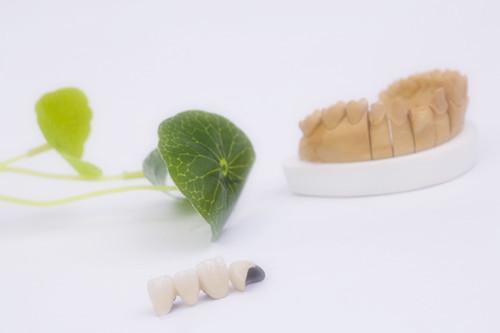 牙科贵金属(牙科贵金属铸造合金成分)