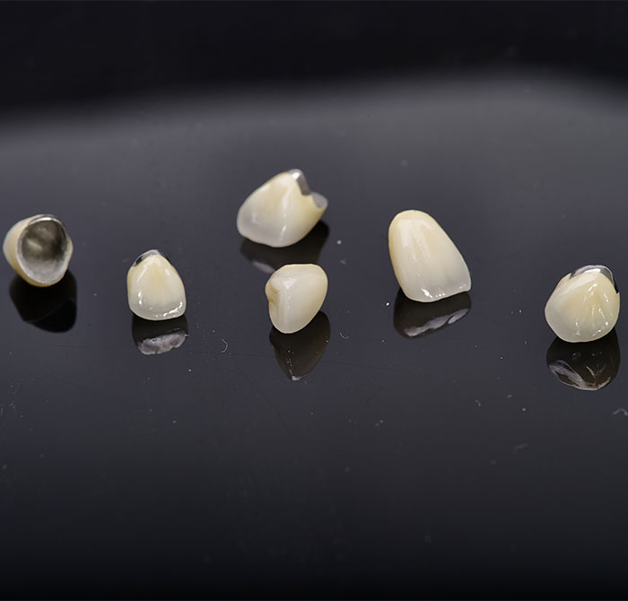 贵金属牙桩(贵金属牙桩影响核磁共振吗) 贵金属牙桩(贵金属牙桩影响核磁共振吗)