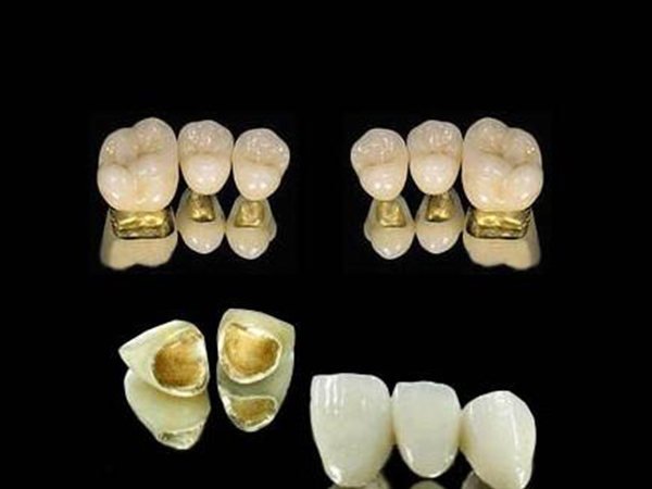 贵金属牙桩(贵金属牙桩多少钱)