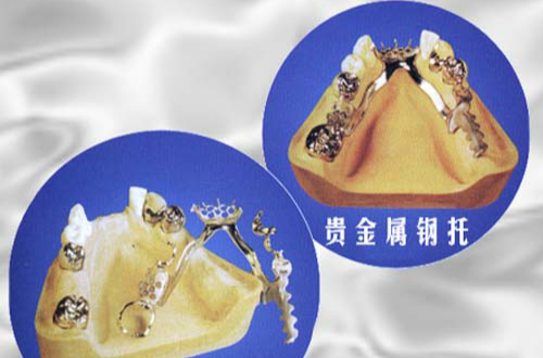 海融贵金属(融通金贵金属行情水贝)