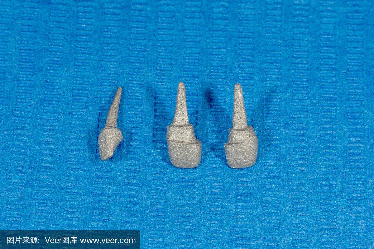 贵金属牙桩(贵金属牙桩最怕三个东西) 贵金属牙桩(贵金属牙桩最怕三个东西)