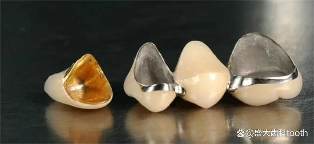 贵金属牙桩(贵金属牙桩最忌三种人) 贵金属牙桩(贵金属牙桩最忌三种人)