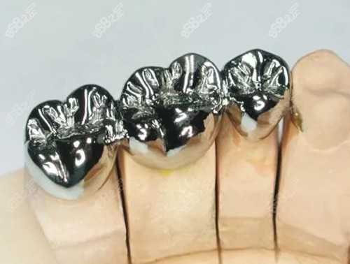 贵金属牙桩(贵金属牙桩的分类)